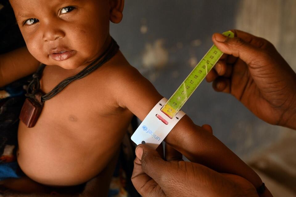 A baby is being weighed and screened for malnutrition at the UNICEF-supported Provincial Hospital of Mao, in eastern Chad.