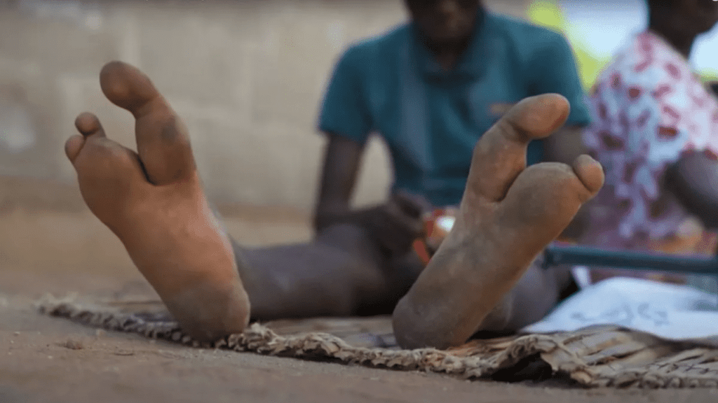 Vadoma tribe | This African tribe has people with only 2 toes that look like Ostrich feet | Viral News