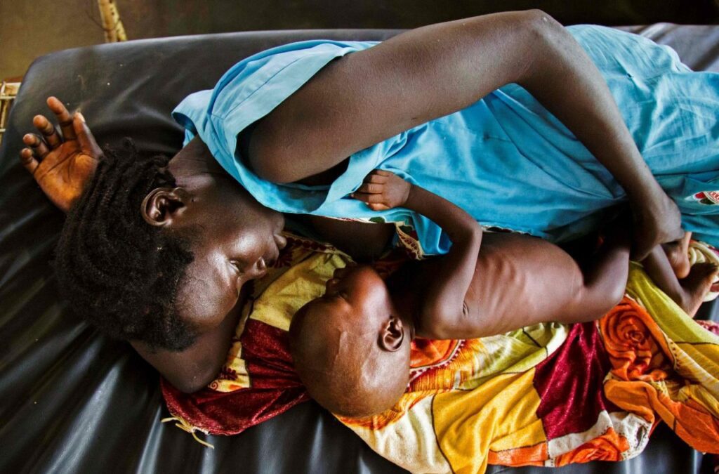 300,000 children in Southern Africa threatened by severe acute malnutrition