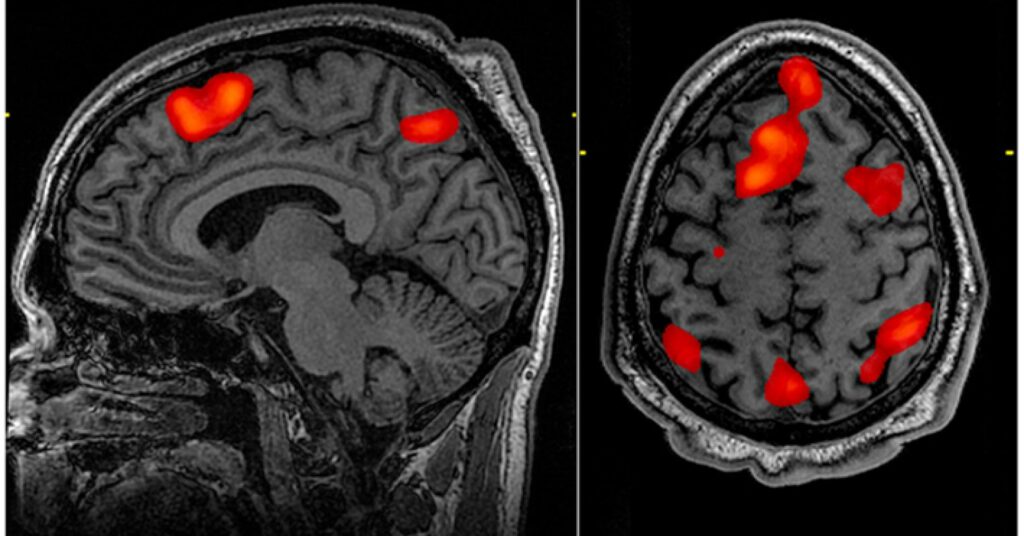 Trying Harder Increases Cognitive Effort and Enhances Memory