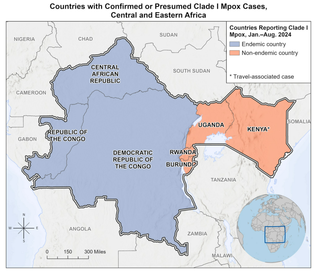 Clade I Mpox Outbreak Originating in Central Africa | Mpox